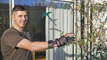 Martin Zeilmann in Murnau mit Teilhandprothese