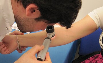 Die kostenlos angebotene Hautkrebsvorsorgeuntersuchung (Hautkrebsscreening) der SVLFG auf diversen Messen besttigte, dass besonders ltere Menschen ein erhhtes Hautkrebsrisiko haben. Mnner waren strker betroffen als Frauen. Das Krebsrisiko hatte bei den ber 65-Jhrigen noch einmal deutlich zugenommen. 
